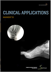 Magnezix Clinical applications