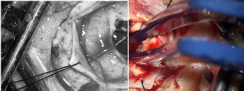 נאמנות לצבע המקור