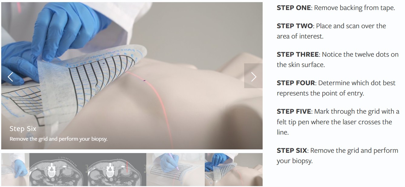 FastFindGrid סימון מיקום ביופסיה במספר שלבים