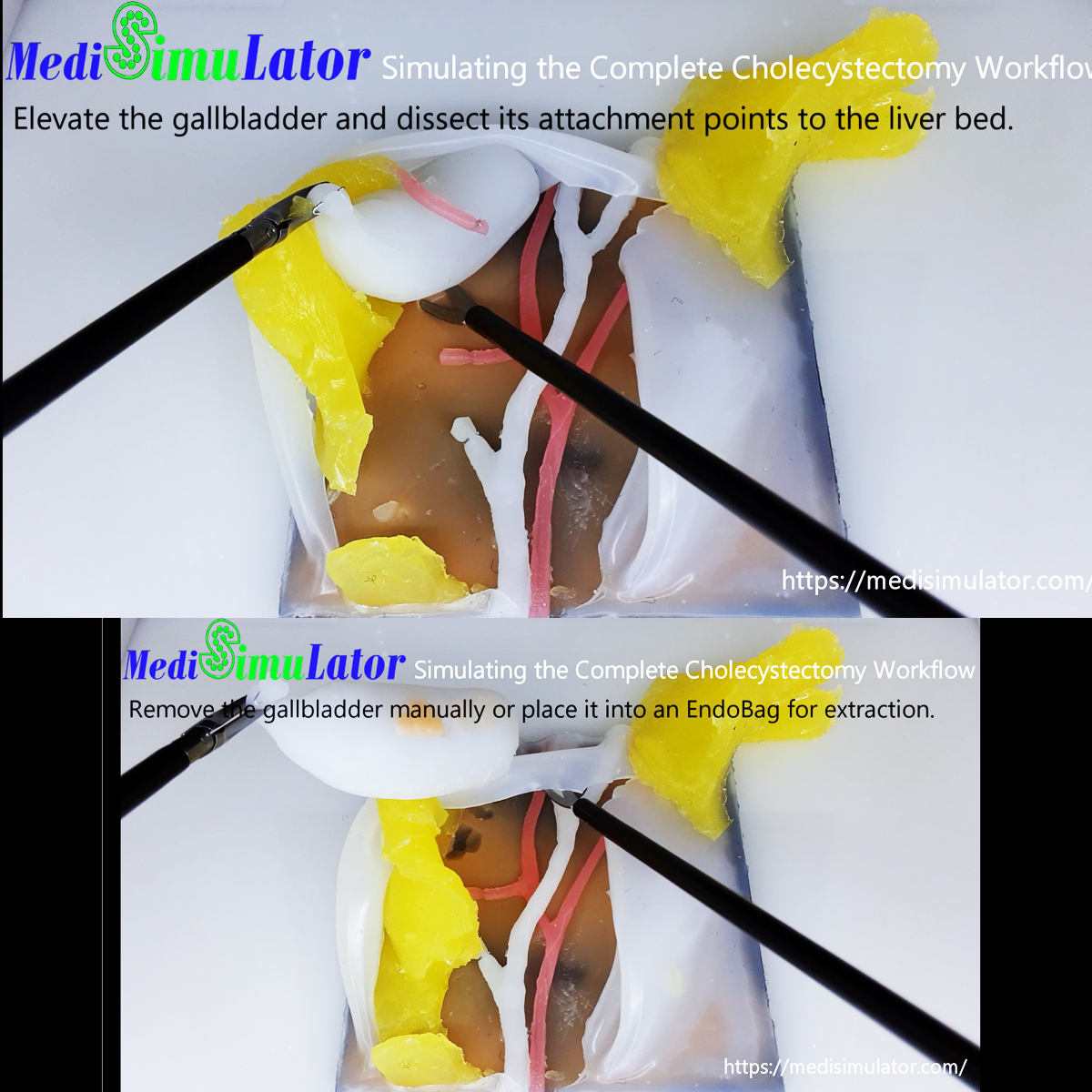 כבד סיליקוני עם כיס מרה מחובר – מאפשר חיתוך והפרדה מדויקת